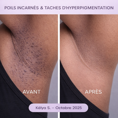 Roll-On Anti-Poils Incarnés et Taches